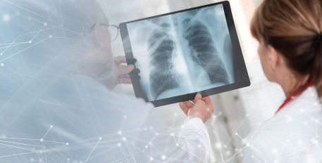 LungScreenFrance : un projet sur l’impact du dépistage du cancer du poumon